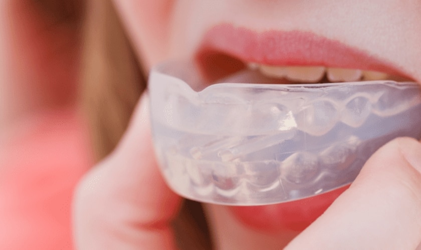 Exploring Different Night Guard Options