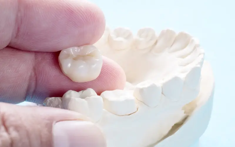 How to Choose Natural Looking Dental Crowns